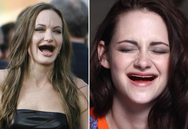 Celebrities Without Teeth.