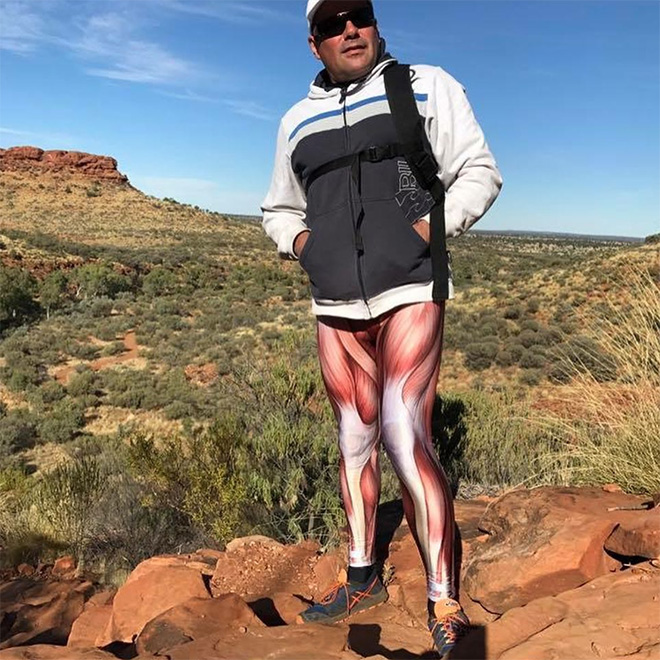 Muscle Leggings Is The New Summer Fashion Trend Nobody Asked For