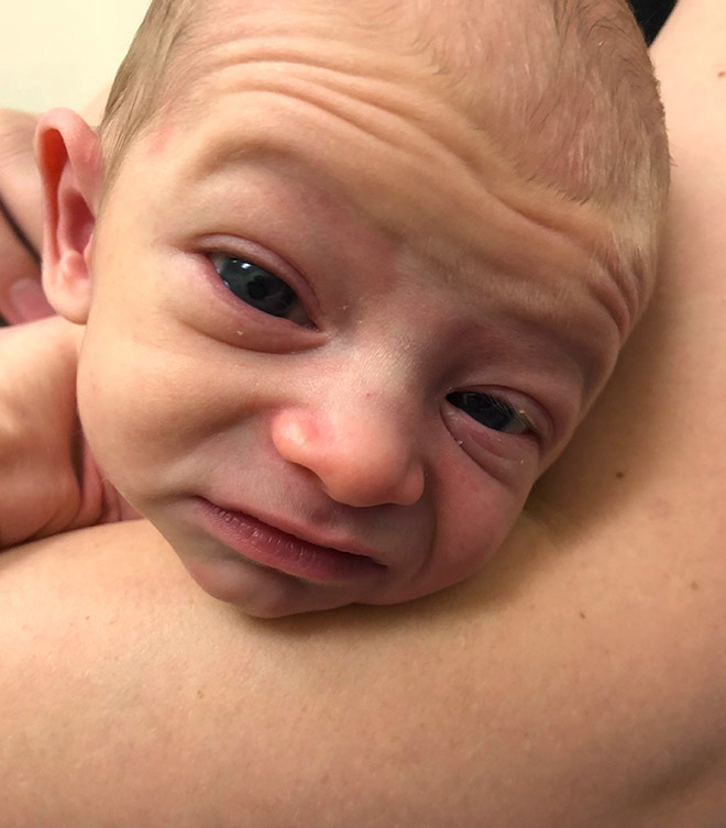 worlds ugliest baby