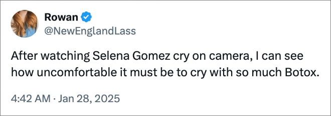 After watching Selena Gomez cry on camera, I can see how uncomfortable it must be to cry with so much Botox.